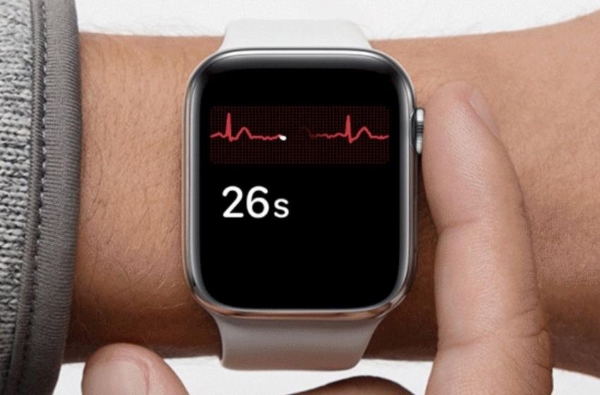 The Apple Watch ECG now available in Ukraine