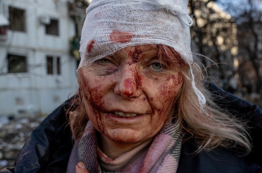 An American photographer has received the International Photography Awards for a photo series depicting the war in Ukraine