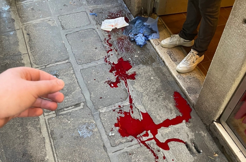 In Venice, a Ukrainian soldier on leave saved a boy with a knife wound