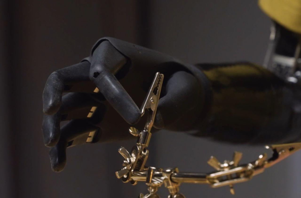 Ukraine launches support programme for prosthetics developers